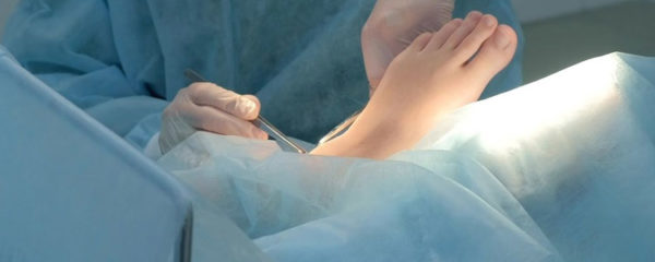 Chirurgie du pied